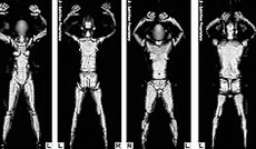 � APA/DPA, Nacktscanner