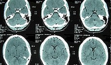 � Fotolia/Samu, CAT scan